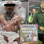 Family of grease truck driver brutally bashed by Mark Sanchez give update on his condition