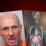 Florida Man Caught With Thermos Up His Rectum, Arrest X-Ray Shows