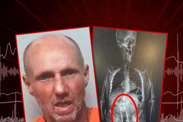 Florida Man Caught With Thermos Up His Rectum, Arrest X-Ray Shows
