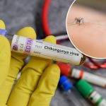 New York health officials confirm state’s first locally acquired case of chikungunya virus