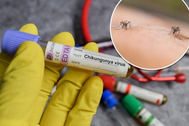 New York health officials confirm state’s first locally acquired case of chikungunya virus