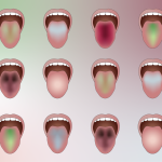This AI Spots Disease by Reading Your Tongue’s Color
