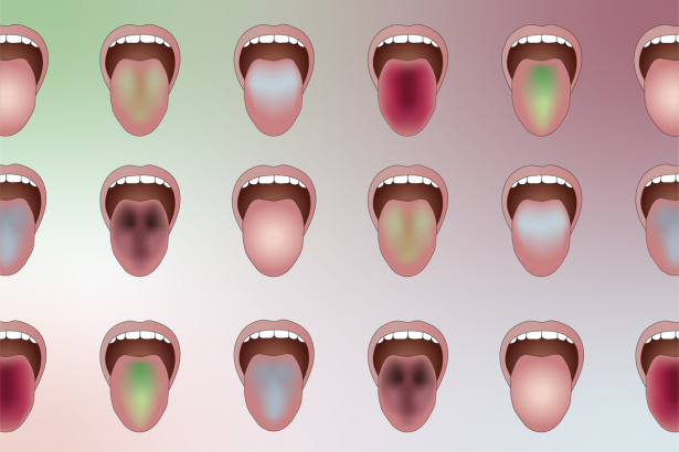 This AI Spots Disease by Reading Your Tongue’s Color
