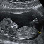 Priests for Life: Call on the FDA to End Death by Chemical Abortion | The Gateway Pundit | by Guest Contributor