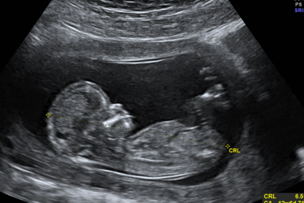 Priests for Life: Call on the FDA to End Death by Chemical Abortion | The Gateway Pundit | by Guest Contributor