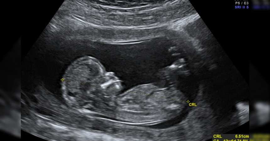 Priests for Life: Call on the FDA to End Death by Chemical Abortion | The Gateway Pundit | by Guest Contributor