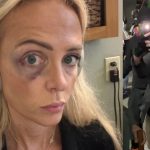Portland Police Bureau Blames Conservative Journalist for Being Attacked by Antifa, Claims She ‘Instigated’ by Simply Being There | The Gateway Pundit | by Cassandra MacDonald