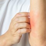 A Promising New Treatment for the 84 Million Americans Suffering from Skin Conditions | The Gateway Pundit | by Promoted Post