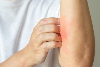 A Promising New Treatment for the 84 Million Americans Suffering from Skin Conditions | The Gateway Pundit | by Promoted Post