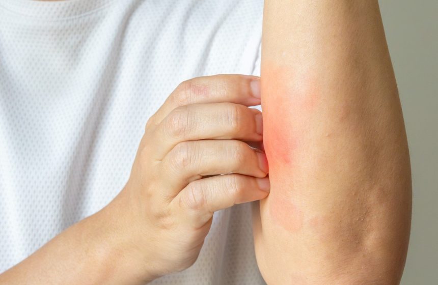 A Promising New Treatment for the 84 Million Americans Suffering from Skin Conditions | The Gateway Pundit | by Promoted Post