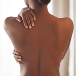 Freeze Branding on Human Skin: A Painful Mistake