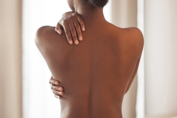 Freeze Branding on Human Skin: A Painful Mistake