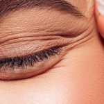 How Lactic Acid Can Improve Your Skin, According To The Experts