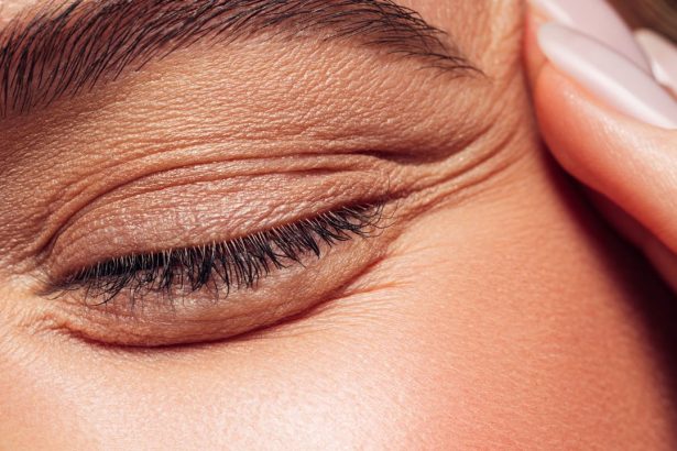 How Lactic Acid Can Improve Your Skin, According To The Experts