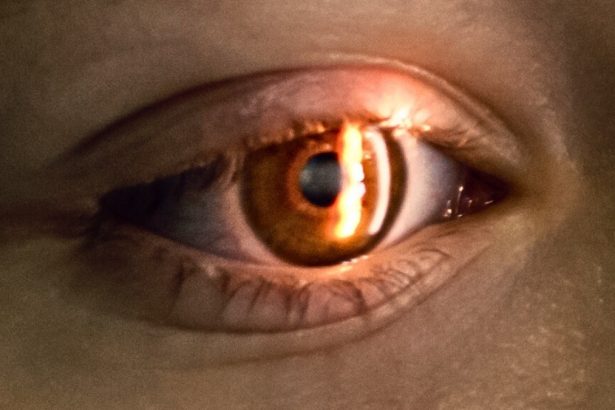 A Simple Eye Scan Could Flag Heart Risks – And How Fast You’re Aging : ScienceAlert