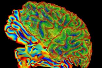 AI Decodes Visual Brain Activity—and Writes Captions for It