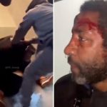 Brooklyn spitter left bloodied by two men ‘tired’ of his vile antics