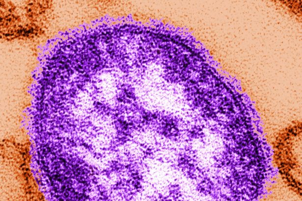 Canada Just Lost Its Measles-Free Status. The U.S. Could Soon Follow
