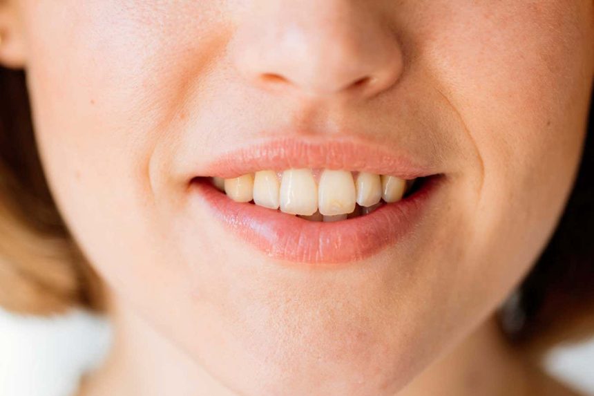 Cavities could be prevented by a gel that restores tooth enamel