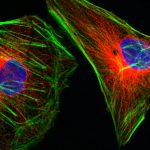 Cervical cancer, HPV shot, lorazepam: Morning Rounds