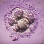 Common IVF test misses some genetic abnormalities in embryos