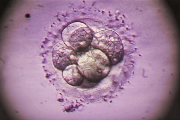 Common IVF test misses some genetic abnormalities in embryos