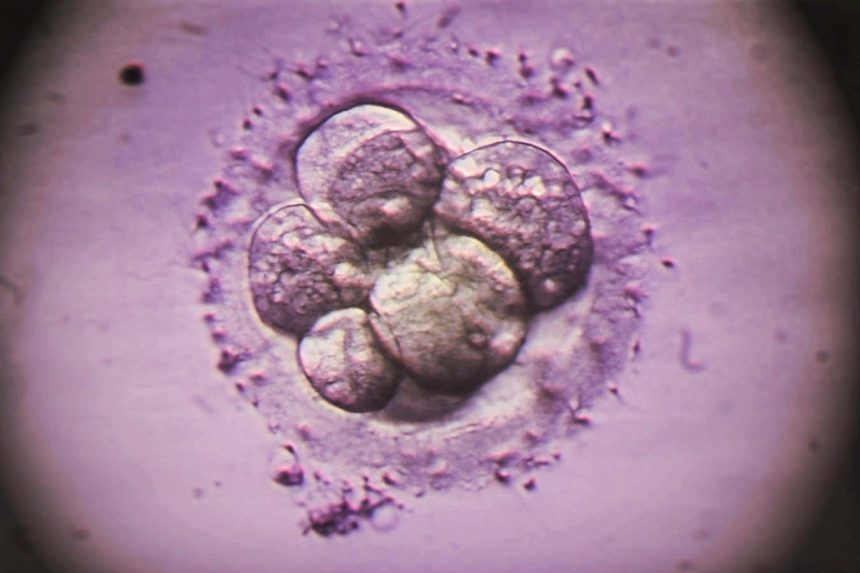 Common IVF test misses some genetic abnormalities in embryos