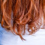Cuts and scrapes may be slower to heal in redheads