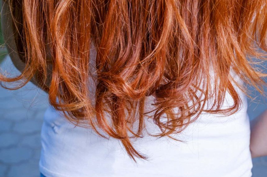 Cuts and scrapes may be slower to heal in redheads
