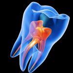 Dentists Could Soon ‘Regrow’ Your Tooth Enamel With a Simple Gel : ScienceAlert