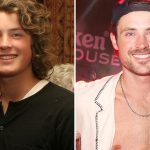 Dylan Efron Good Genes or Good Docs?!