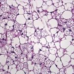 Early-life ketone signaling may shape long-term metabolic health