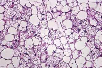 Early-life ketone signaling may shape long-term metabolic health