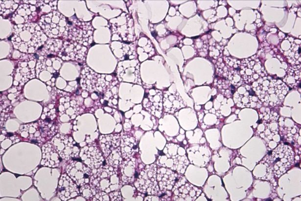 Early-life ketone signaling may shape long-term metabolic health