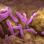 Experts Explain How Botulism Toxin Can End Up in Baby Formula