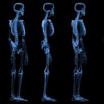 Fake CPR, Metsera, Trump drug pricing deal: Morning Rounds