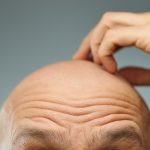 Fat Cells Could Be The Secret to Rapid Hair Regrowth : ScienceAlert