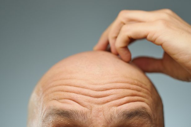 Fat Cells Could Be The Secret to Rapid Hair Regrowth : ScienceAlert