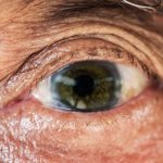 First-of-Its-Kind Treatment Boosts Vision in Human Trial, Scientists Report : ScienceAlert