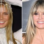 Heidi Klum — Good Genes or Good Docs?!