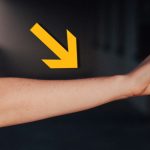 Human Arms Keep Growing an Extra Artery, Showing We’re Still Evolving : ScienceAlert