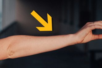 Human Arms Keep Growing an Extra Artery, Showing We’re Still Evolving : ScienceAlert