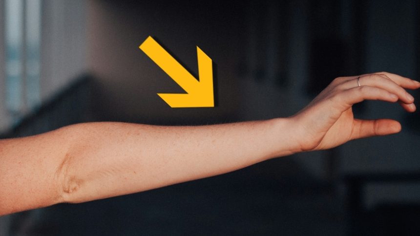 Human Arms Keep Growing an Extra Artery, Showing We’re Still Evolving : ScienceAlert