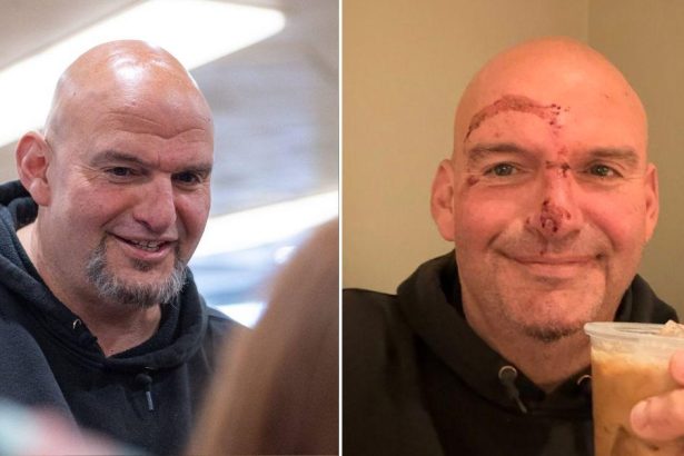 John Fetterman Shows Off Horrific Stitches and Facial Injuries After Fall