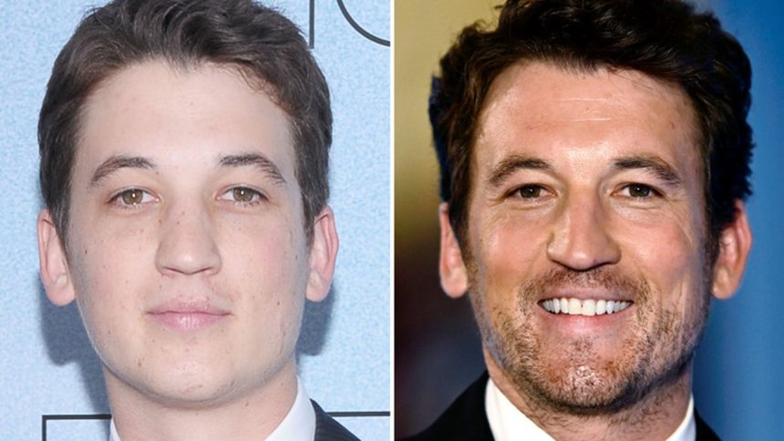 Miles Teller — Good Genes or Good Docs?!