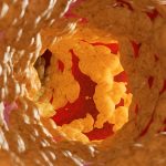 New Drug Lowers ‘Bad’ Cholesterol by 58% in Clinical Trial : ScienceAlert