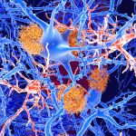 One of Our Biggest Hopes For Alzheimer’s Treatment Doesn’t Seem to Work : ScienceAlert