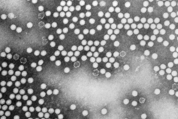 Poliovirus, SNAP, malaria, MAHA summit: Morning Rounds