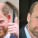 Prince Harry Admits He’s Going Bald After Mocking Brother’s Lack of Hair