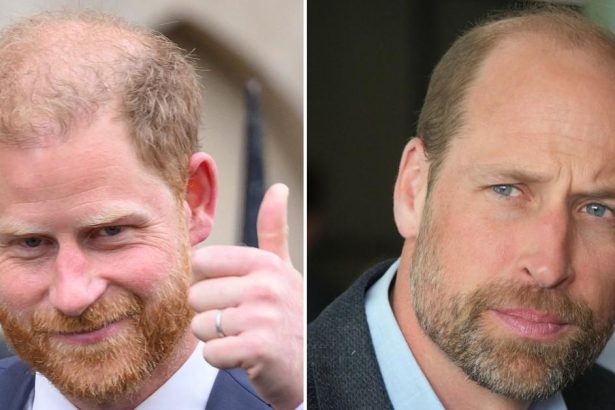 Prince Harry Admits He’s Going Bald After Mocking Brother’s Lack of Hair